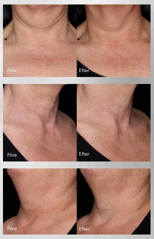 ZO Skin Health Neck Complex
